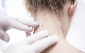 Czy badanie dermatoskopowe boli?