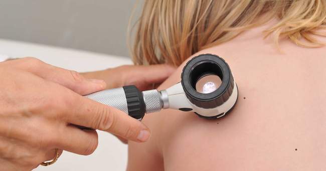 dermatoskop ręczny dermatoskop ręczny