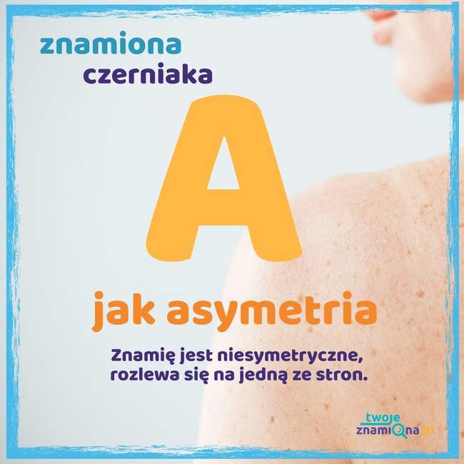 Asymetria Asymetria