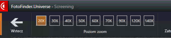 Możliwości powiększenia zmiany przy zastosowaniu kamery Medicam 1000