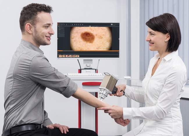 Wideodermatoskop FotoFinder Vexia - lekarz podczas badania znamion pacjenta system komputerowy diagnostyka czerniaka