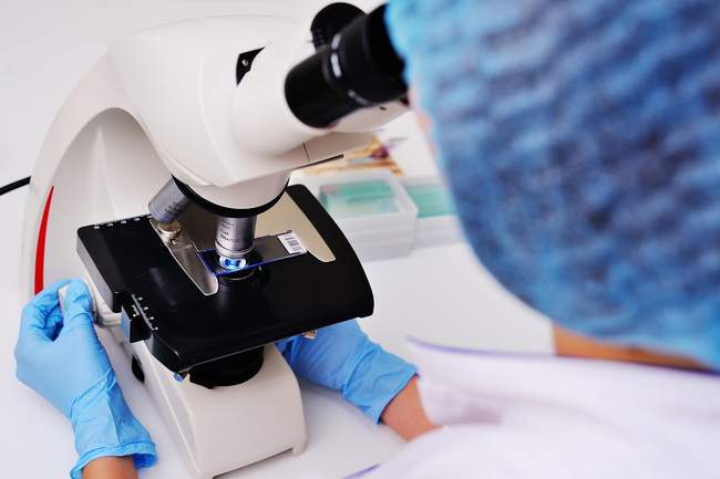 Badanie histopatologiczne po chirurgicznym usunięciu znamienia Badanie histopatologiczne po chirurgicznym usunięciu znamienia