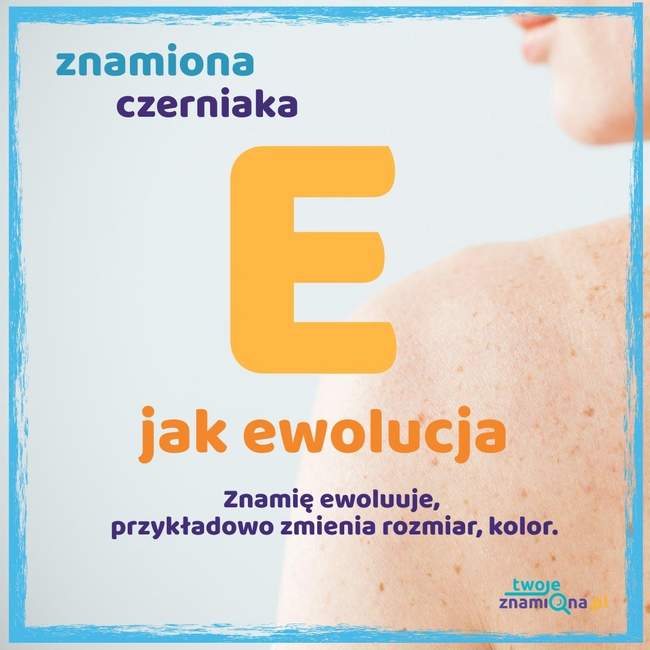 Ewolucja Ewolucja
