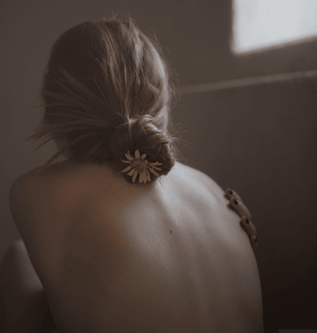 Lokalizacja czerniaka Lokalizacja czerniaka