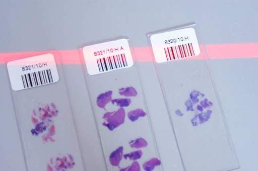 Szkiełka do rozmazu, które trafiają do laboratorium na badanie histopatologiczne Szkiełka do rozmazu, które trafiają do laboratorium na badanie histopatologiczne