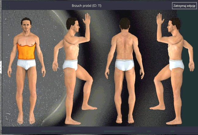 Fantom wideodermatoskop - cyfrowe mapowanie body mapping lokalizacji wszystkich znamion na ciele pacjenta system