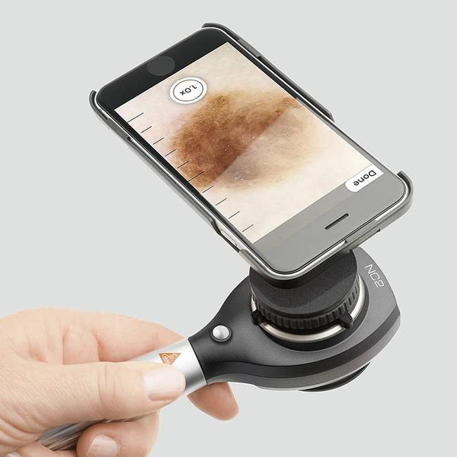 Dermatoskop ręczny Delta NC2, powiększenie do 10 x. Dermatoskop ręczny Delta NC2, powiększenie do 10 x.