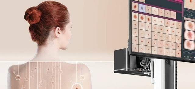 mapowanie znamion mapowanie znamion