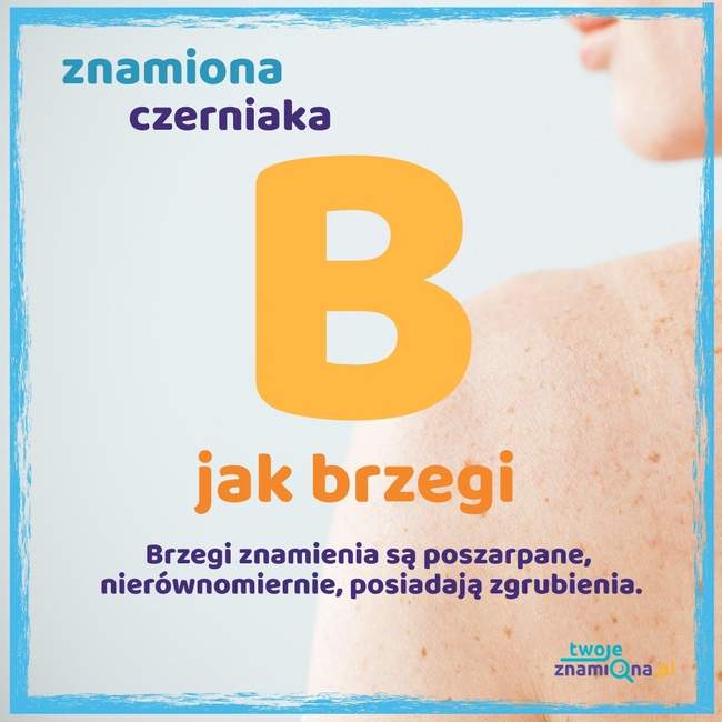 Brzegi Brzegi