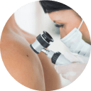 Dermatoskopowe Badanie Znamion