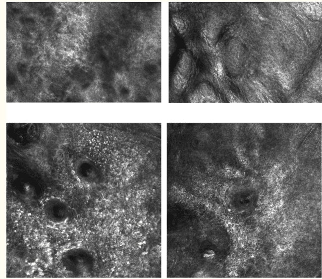 obraz mikroskopu konfokalnego obraz mikroskopu konfokalnego