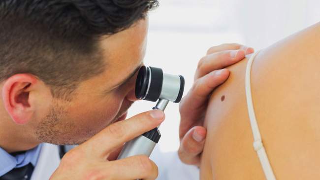 Badanie znamion (pieprzyków) za pomocą dermatoskopu. Badanie znamion (pieprzyków) za pomocą dermatoskopu.