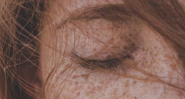 Jasna karnacja - zwiększa ryzyko pojawienia się objawów czerniaka. Jasna karnacja - zwiększa ryzyko pojawienia się objawów czerniaka.